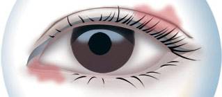 CBA***得分手發(fā)高燒吸氧0得分 教練：賓館房間新裝修，甲醛中毒導致的！