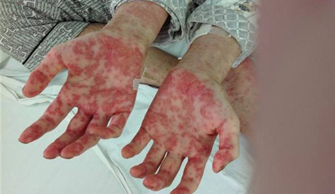 室內(nèi)甲醛檢測(cè)治理，你不得不需要了解的三點(diǎn)！