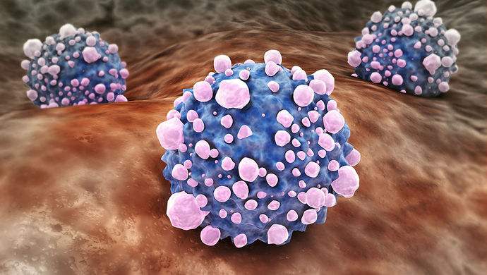 平時(shí)不注意甲醛超標(biāo)，50歲女子劇烈頭痛、惡心干嘔，一查已是癌癥晚期！