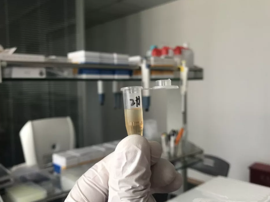 水煮花生含甲醛？實(shí)測(cè)多家燒烤店結(jié)果太可怕！