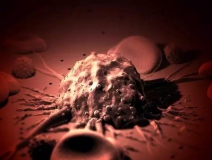 癌癥、白血病越來越多，是因為時代在進步而導(dǎo)致的嗎？