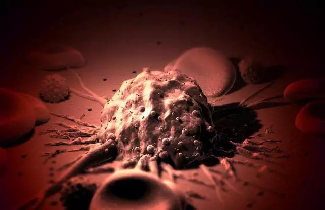 癌癥、白血病越來越多，是因為時代在進步而導(dǎo)致的嗎？